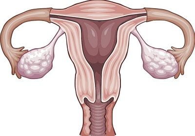 caracteristicas de los ovarios